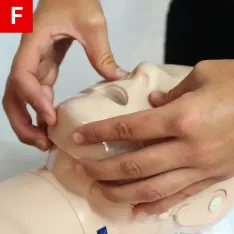 BLS Figure 4 F jaw-thrust maneuver