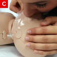 CPR Figure 26 C Blow for one second and watch the chest rise
