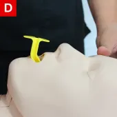 OPA is placed in the mouth 2