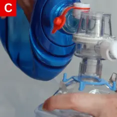 ACLS Figure 6 C The second rescuer gives two breaths over one second